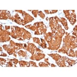 Immunohistochemistry - Anti-DBC2 Antibody [DBC2/3361] - BSA and Azide free (A278200) - Antibodies.com