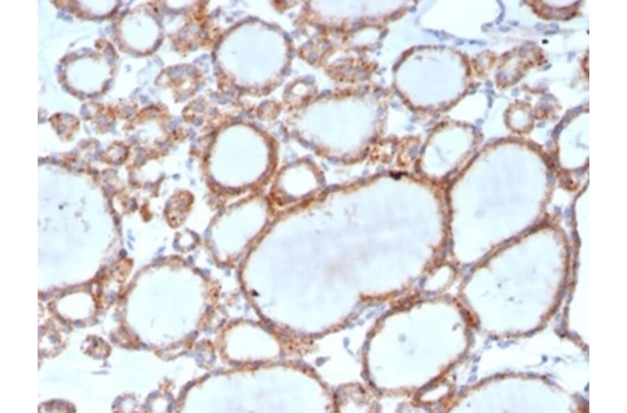 Immunohistochemistry - Anti-DBC2 Antibody [DBC2/3361] - BSA and Azide free (A278200) - Antibodies.com