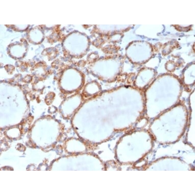 Immunohistochemistry - Anti-DBC2 Antibody [DBC2/3361] - BSA and Azide free (A278200) - Antibodies.com