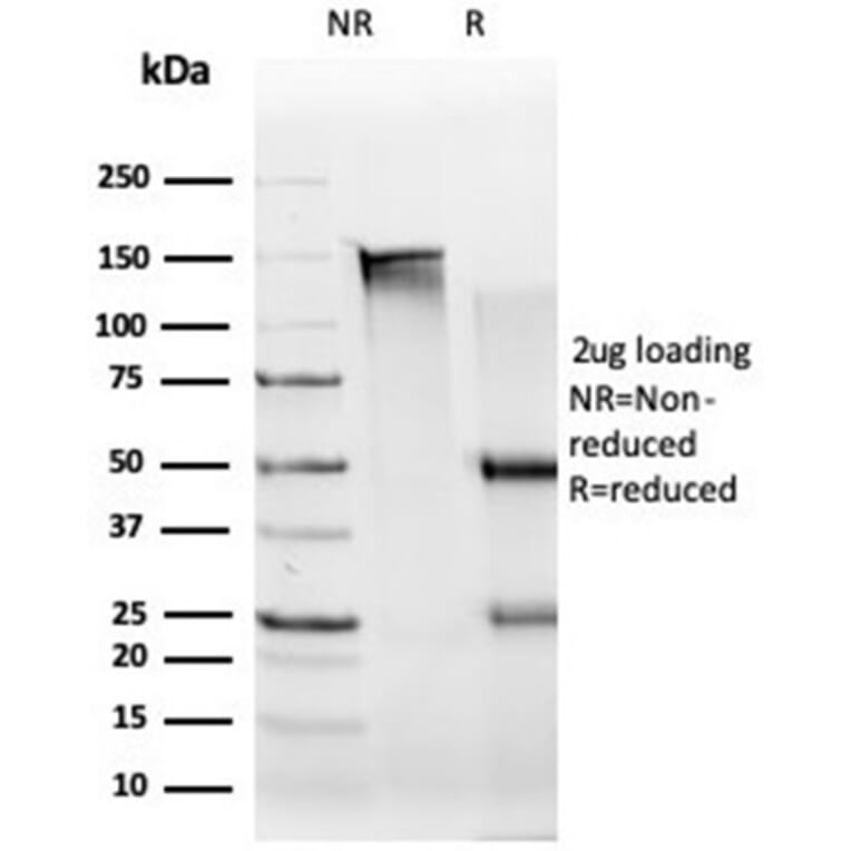 SDS-PAGE - Anti-UBR2 Antibody [PCRP-UBR2-1D12] - BSA and Azide free (A278201) - Antibodies.com