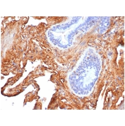 Immunohistochemistry - Anti-Fibronectin Antibody [FN1/3569] - BSA and Azide free (A278202) - Antibodies.com