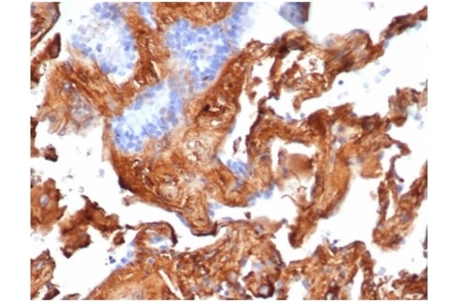 Immunohistochemistry - Anti-Fibronectin Antibody [FN1/3569] - BSA and Azide free (A278202) - Antibodies.com
