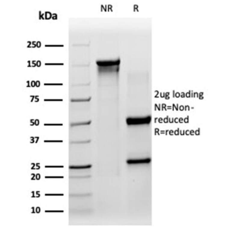 SDS-PAGE - Anti-SIRT3 Antibody [PCRP-SIRT3-1C10] - BSA and Azide free (A278203) - Antibodies.com
