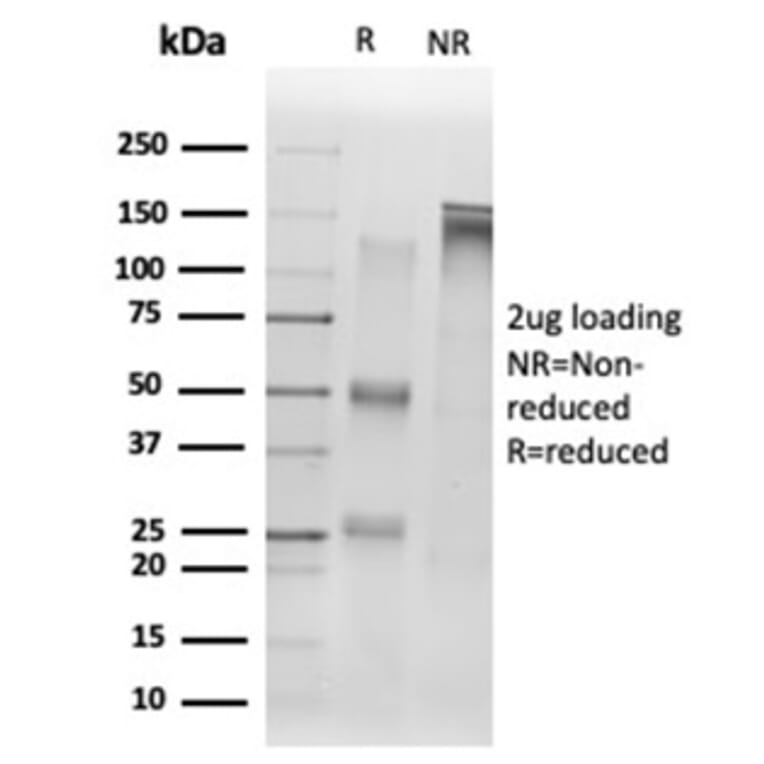 SDS-PAGE - Anti-SIRT1 Antibody [PCRP-SIRT1-1E11] - BSA and Azide free (A278204) - Antibodies.com