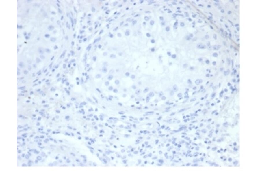 Immunohistochemistry - Anti-Placental Alkaline Phosphatase Antibody [rALP/870] - BSA and Azide free (A278205) - Antibodies.com