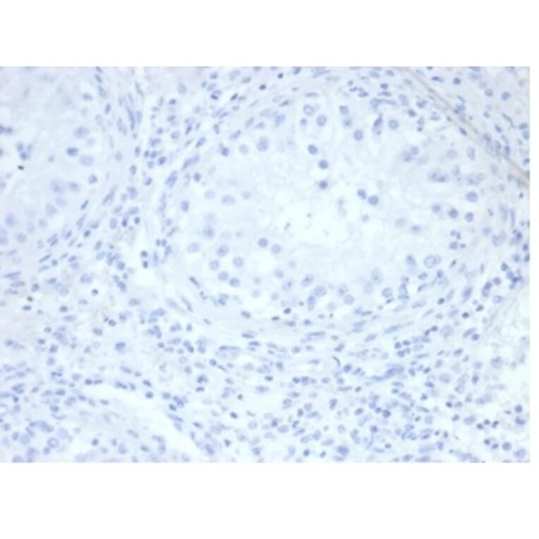 Immunohistochemistry - Anti-Placental Alkaline Phosphatase Antibody [rALP/870] - BSA and Azide free (A278205) - Antibodies.com