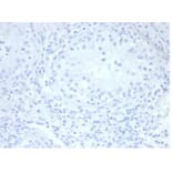 Immunohistochemistry - Anti-Placental Alkaline Phosphatase Antibody [rALP/870] - BSA and Azide free (A278205) - Antibodies.com