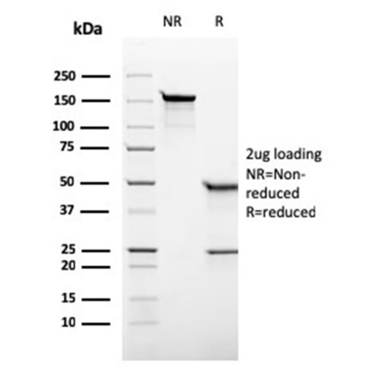 SDS-PAGE - Anti-Placental Alkaline Phosphatase Antibody [rALP/870] - BSA and Azide free (A278205) - Antibodies.com