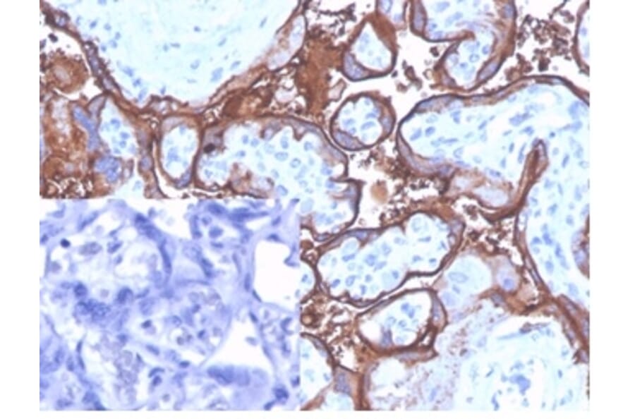 Immunohistochemistry - Anti-Placental Alkaline Phosphatase Antibody [ALPP/4109] - BSA and Azide free (A278206) - Antibodies.com