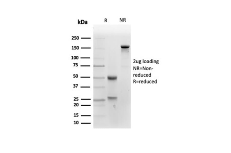 SDS-PAGE - Anti-Placental Alkaline Phosphatase Antibody [ALPP/4109] - BSA and Azide free (A278206) - Antibodies.com
