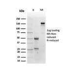 SDS-PAGE - Anti-Placental Alkaline Phosphatase Antibody [ALPP/4109] - BSA and Azide free (A278206) - Antibodies.com