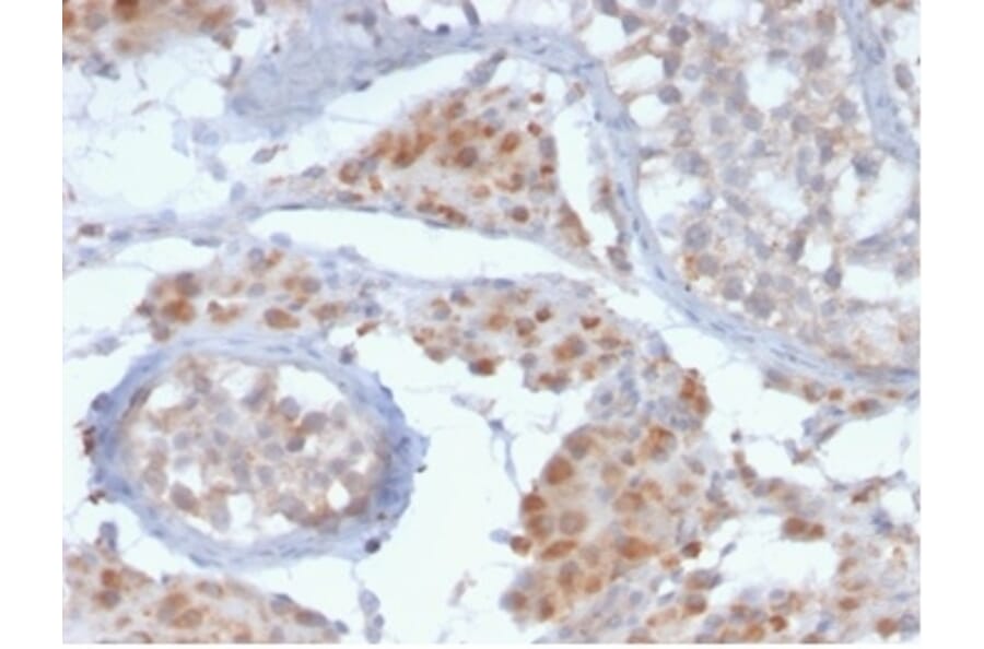 Immunohistochemistry - Anti-GCET2 Antibody [HGAL/2373] - BSA and Azide free (A278209) - Antibodies.com