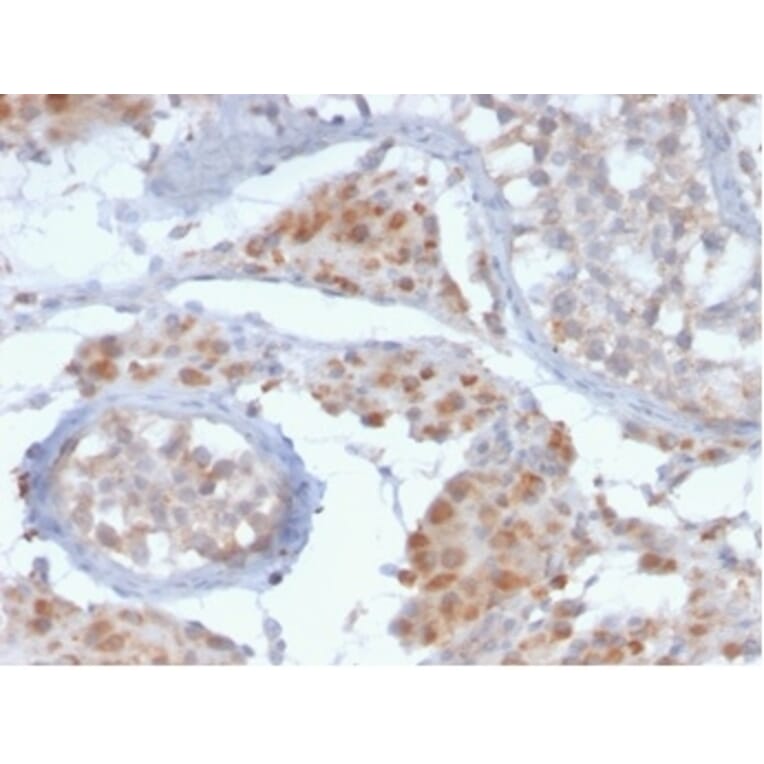 Immunohistochemistry - Anti-GCET2 Antibody [HGAL/2373] - BSA and Azide free (A278209) - Antibodies.com