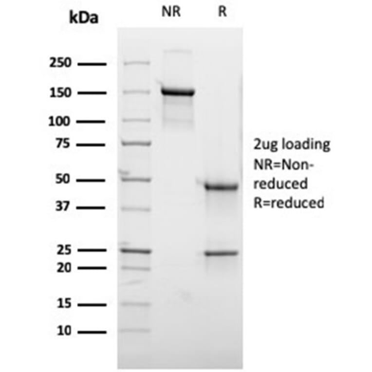 SDS-PAGE - Anti-GCET2 Antibody [HGAL/2373] - BSA and Azide free (A278209) - Antibodies.com