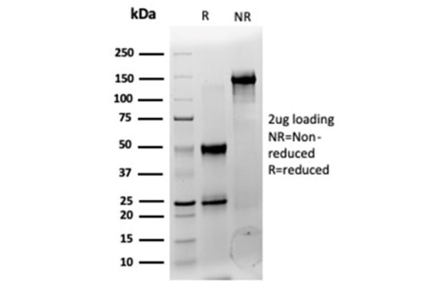 SDS-PAGE - Anti-CNOT10 Antibody [PCRP-CNOT10-1D5] - BSA and Azide free (A278210) - Antibodies.com