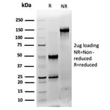 SDS-PAGE - Anti-CNOT10 Antibody [PCRP-CNOT10-1D5] - BSA and Azide free (A278210) - Antibodies.com