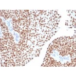 Immunohistochemistry - Anti-GATA3 Antibody [GATA3/6664] - BSA and Azide free (A278211) - Antibodies.com