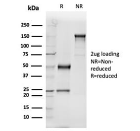 SDS-PAGE - Anti-Vitamin D Binding Protein Antibody [VDBP/4481] - BSA and Azide free (A278213) - Antibodies.com