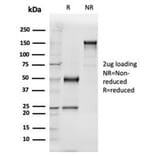 SDS-PAGE - Anti-Vitamin D Binding Protein Antibody [VDBP/4481] - BSA and Azide free (A278213) - Antibodies.com