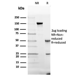 SDS-PAGE - Anti-Vitamin D Binding Protein Antibody [VDBP/4482] - BSA and Azide free (A278214) - Antibodies.com