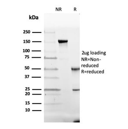 SDS-PAGE - Anti-Vitamin D Binding Protein Antibody [VDBP/4482] - BSA and Azide free (A278214) - Antibodies.com