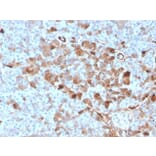 Immunohistochemistry - Anti-Vitamin D Binding Protein Antibody [VDBP/4482] - BSA and Azide free (A278214) - Antibodies.com