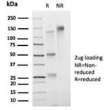 SDS-PAGE - Anti-FOXB1 Antibody [PCRP-FOXB1-1B7] - BSA and Azide free (A278218) - Antibodies.com
