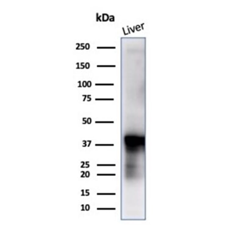 Western Blot - Anti-Glutamine Synthetase Antibody [GLUL/6604] - BSA and Azide free (A278220) - Antibodies.com