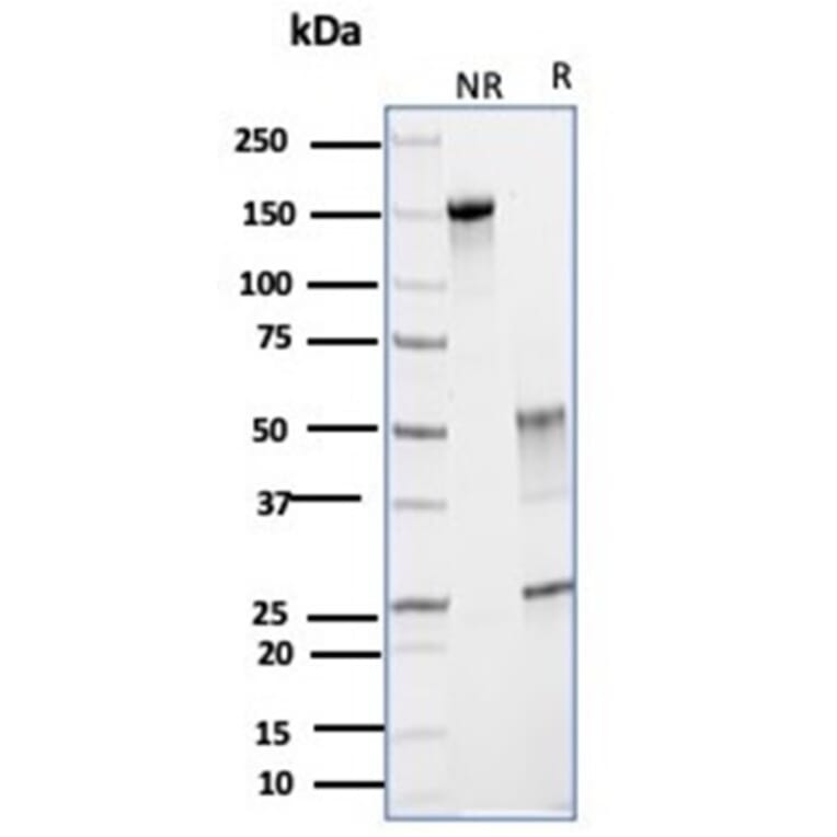 SDS-PAGE - Anti-Glutamine Synthetase Antibody [GLUL/6599] - BSA and Azide free (A278221) - Antibodies.com