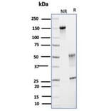 SDS-PAGE - Anti-Glutamine Synthetase Antibody [GLUL/6599] - BSA and Azide free (A278221) - Antibodies.com