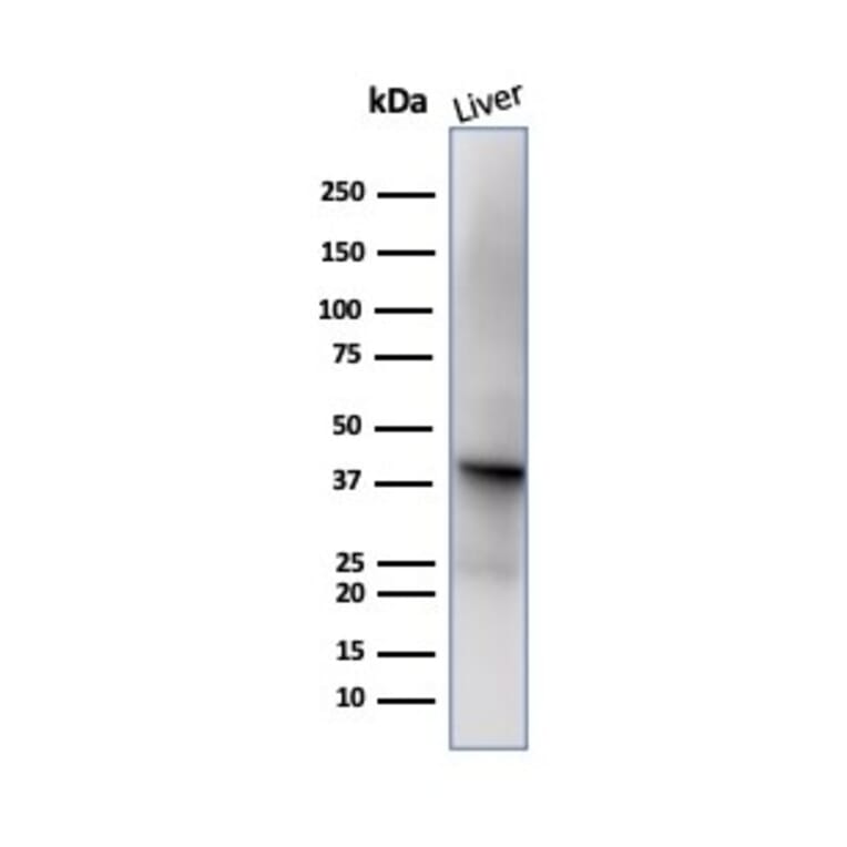 Western Blot - Anti-Glutamine Synthetase Antibody [GLUL/6599] - BSA and Azide free (A278221) - Antibodies.com