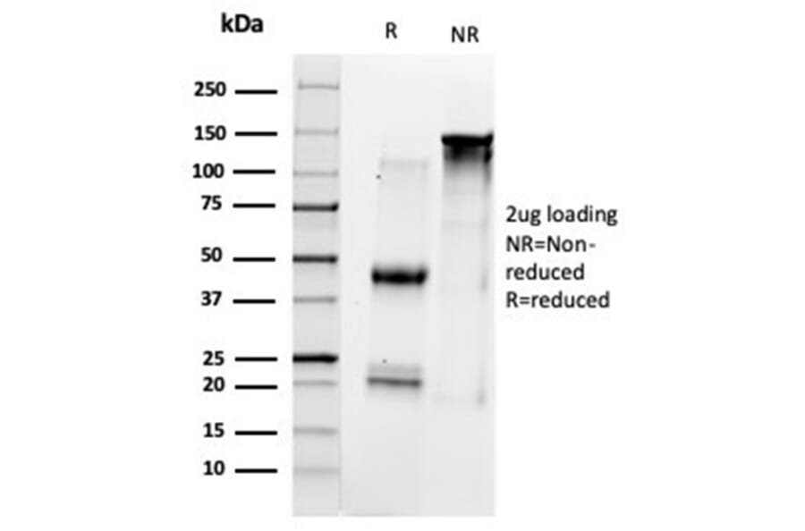 SDS-PAGE - Anti-TFIIB Antibody [PCRP-GTF2B-1D1] - BSA and Azide free (A278226) - Antibodies.com
