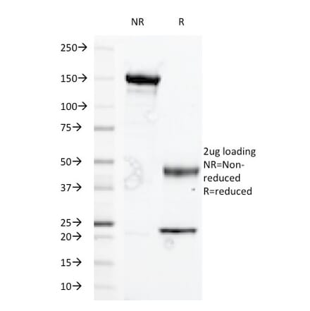 SDS-PAGE - Anti-Glycophorin A Antibody [A84-B/H2] - BSA and Azide free (A278227) - Antibodies.com