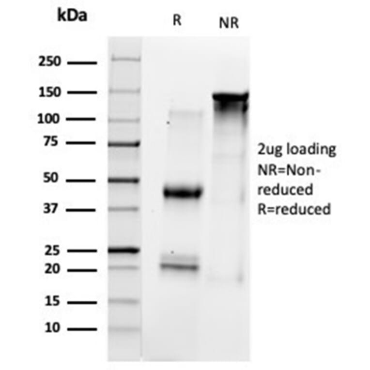 SDS-PAGE - Anti-HDAC1 Antibody [PCRP-HDAC1-1B7] - BSA and Azide free (A278228) - Antibodies.com