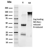 SDS-PAGE - Anti-HDAC1 Antibody [PCRP-HDAC1-1B7] - BSA and Azide free (A278228) - Antibodies.com