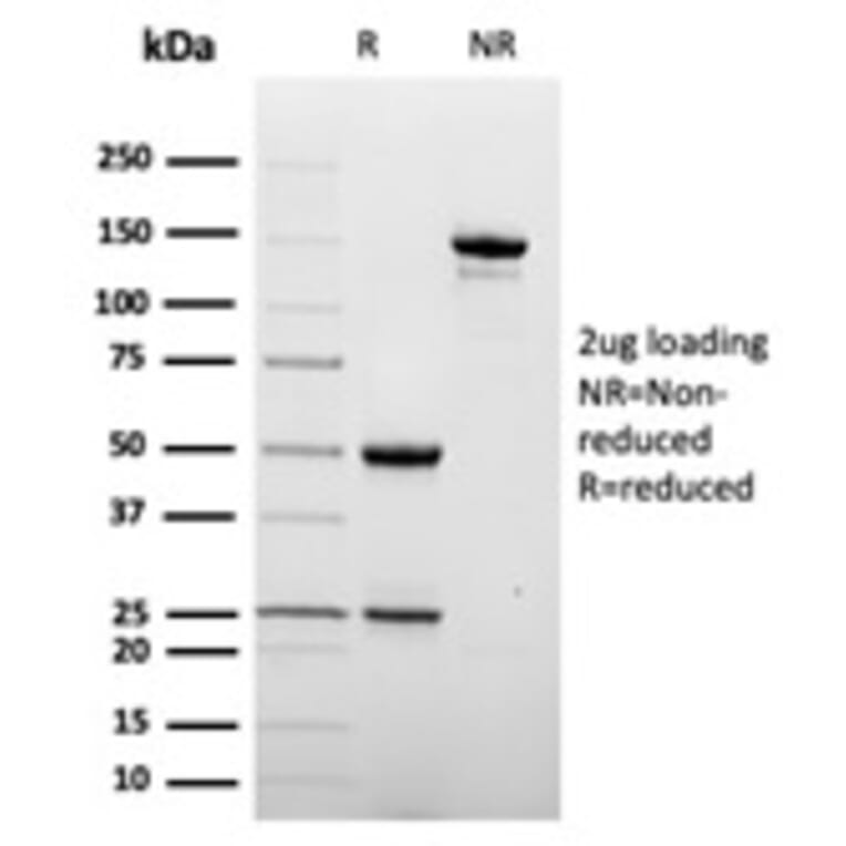 SDS-PAGE - Anti-DC-SIGN Antibody [C209/6774] - BSA and Azide free (A278229) - Antibodies.com