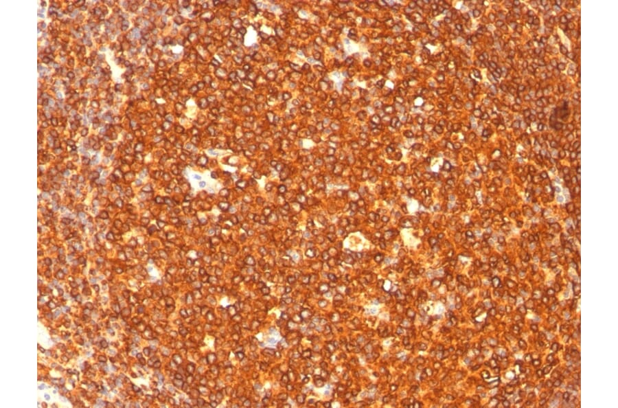 Immunohistochemistry - Anti-HLA DR Antibody [SPM289] - BSA and Azide free (A278230) - Antibodies.com