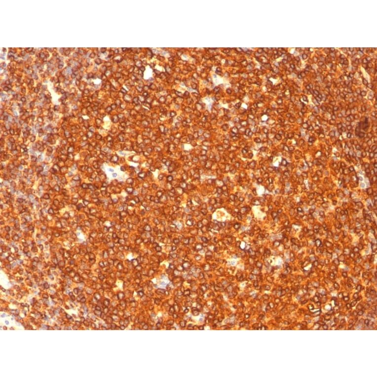 Immunohistochemistry - Anti-HLA DR Antibody [SPM289] - BSA and Azide free (A278230) - Antibodies.com