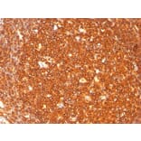 Immunohistochemistry - Anti-HLA DR Antibody [SPM289] - BSA and Azide free (A278230) - Antibodies.com