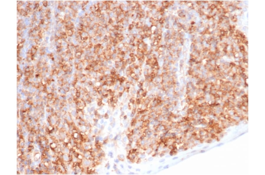 Immunohistochemistry - Anti-HLA G Antibody [HLAG/6686] - BSA and Azide free (A278231) - Antibodies.com