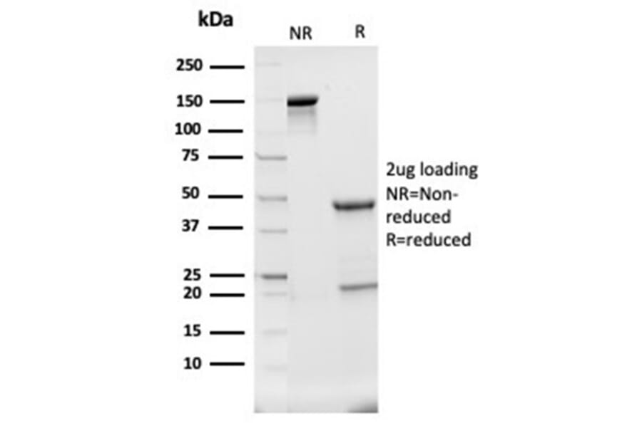 SDS-PAGE - Anti-Haptoglobin Antibody [HP/3840] - BSA and Azide free (A278233) - Antibodies.com