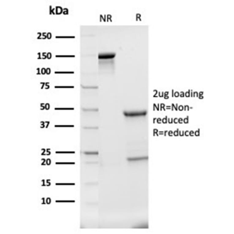SDS-PAGE - Anti-Haptoglobin Antibody [HP/3840] - BSA and Azide free (A278233) - Antibodies.com