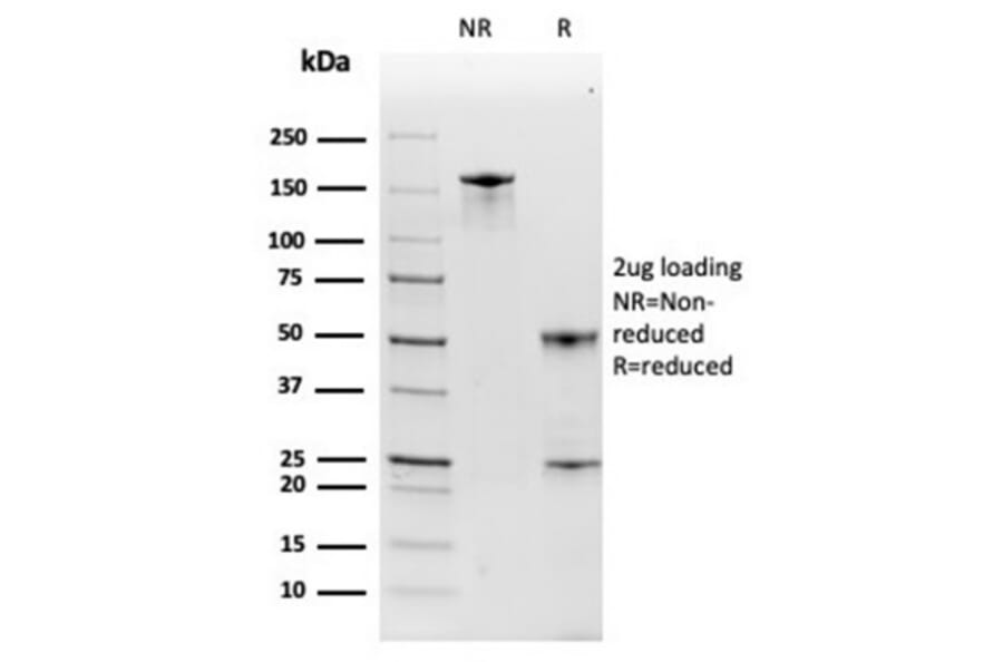 SDS-PAGE - Anti-Haptoglobin Antibody [HP/3835] - BSA and Azide free (A278234) - Antibodies.com