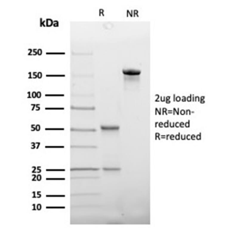 SDS-PAGE - Anti-Haptoglobin Antibody [HP/3837] - BSA and Azide free (A278235) - Antibodies.com