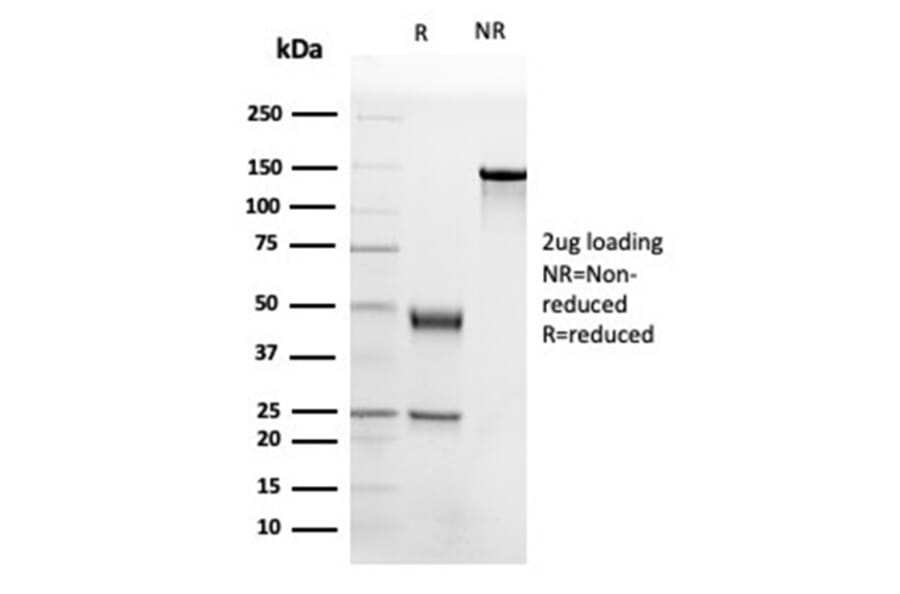 SDS-PAGE - Anti-Apolipoprotein B Antibody [APOB/4332] - BSA and Azide free (A278237) - Antibodies.com