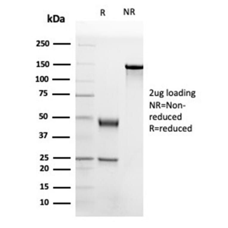 SDS-PAGE - Anti-Apolipoprotein B Antibody [APOB/4332] - BSA and Azide free (A278237) - Antibodies.com