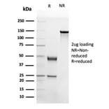 SDS-PAGE - Anti-Apolipoprotein B Antibody [APOB/4332] - BSA and Azide free (A278237) - Antibodies.com