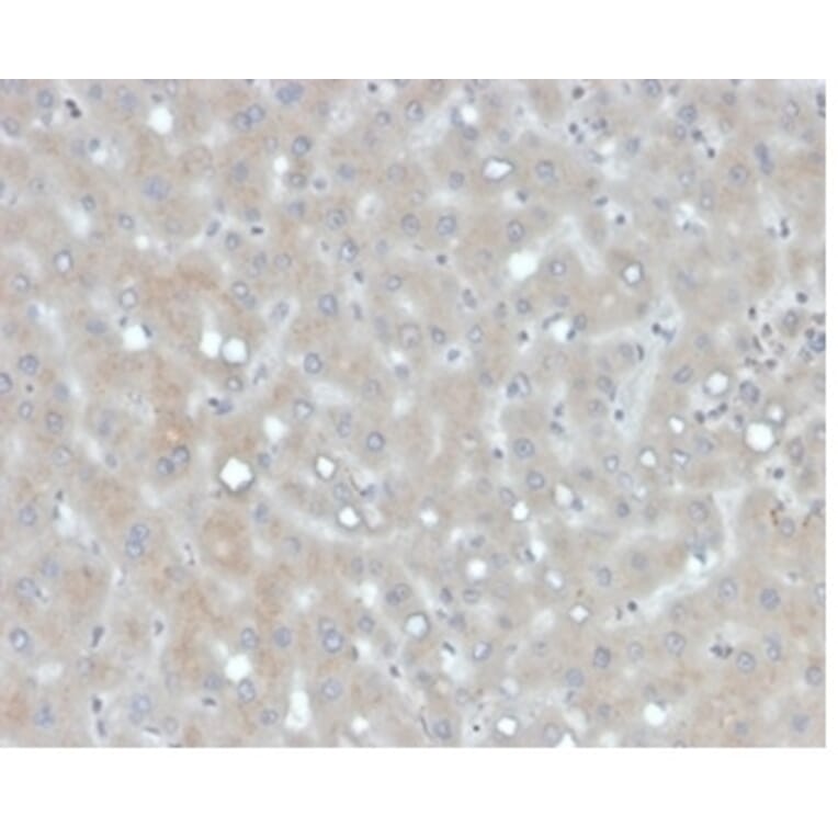 Immunohistochemistry - Anti-Apolipoprotein B Antibody [APOB/4335] - BSA and Azide free (A278238) - Antibodies.com