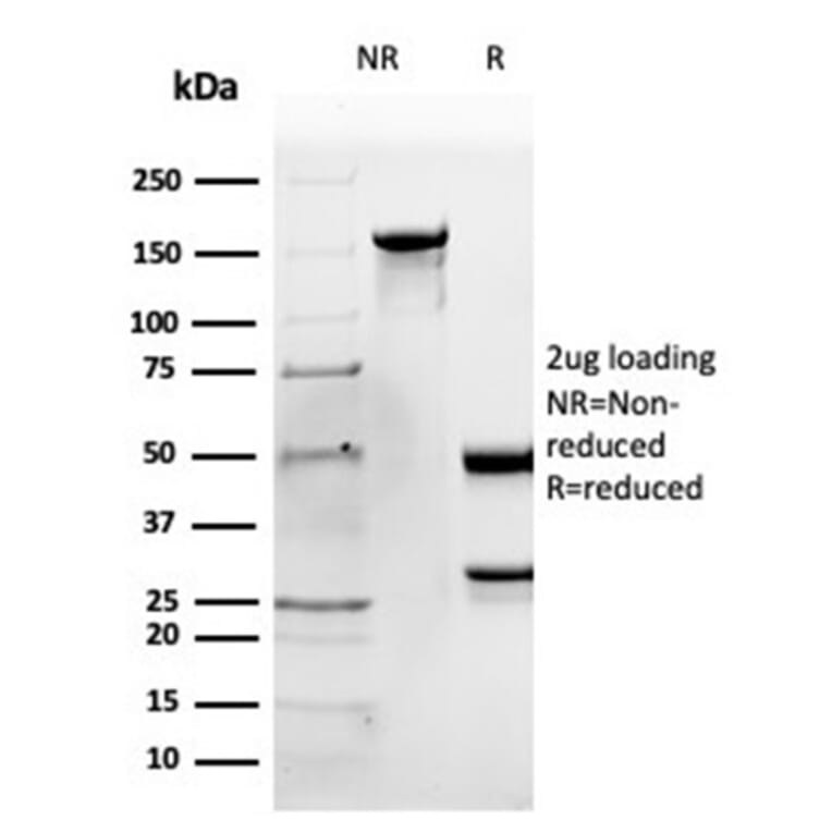 SDS-PAGE - Anti-Apolipoprotein B Antibody [APOB/4335] - BSA and Azide free (A278238) - Antibodies.com