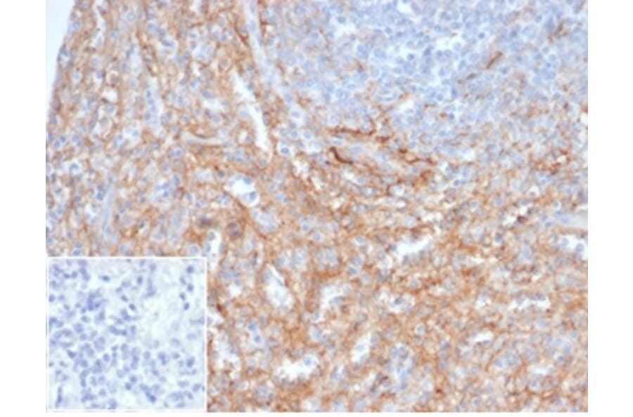Immunohistochemistry - Anti-ICAM1 Antibody [ICAM1/6917] - BSA and Azide free (A278239) - Antibodies.com